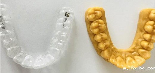 clearcaps