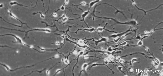 Neuronal progenitor cells