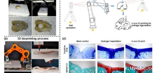 article_Arm_2